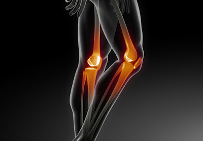 Knee replacement in Chennai