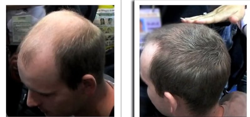 Mightbenewstest This One Ingredients Can Remove White Hairs And