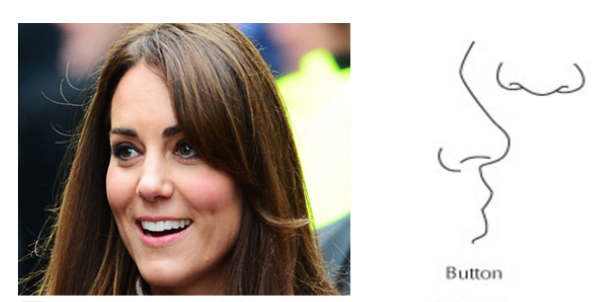 Baby with nose sli,e.