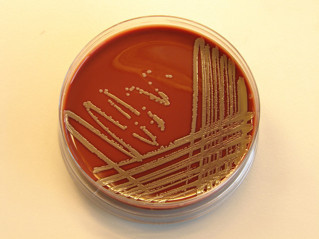 Staphylococcus aureus среда. Стафилококк на ЖСА. Колонии золотистого стафилококка в чашке Петри. Золотистый стафилококк пигмент. Колонии золотистого стафилококка.