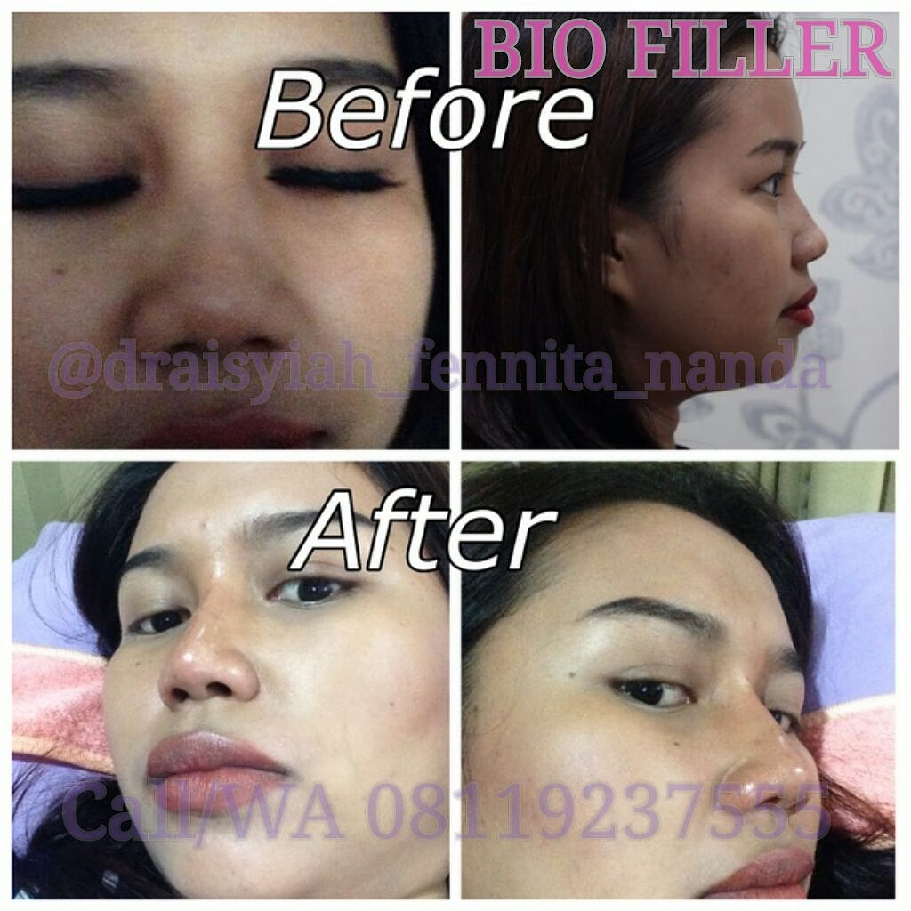 0811 1721 280, Rinanda Skin Care Center