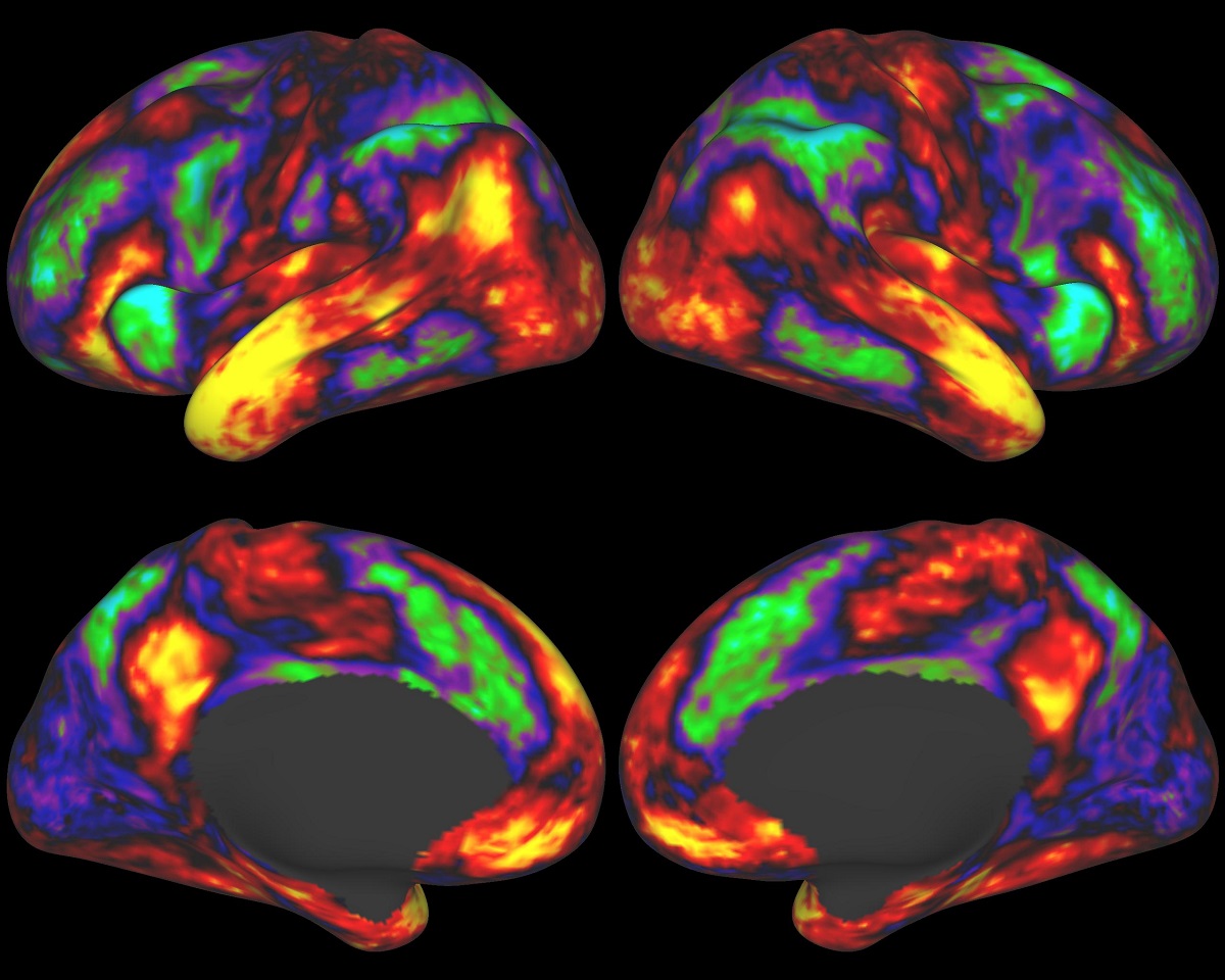 What is brain mapping How is it - Brain%2BMapping