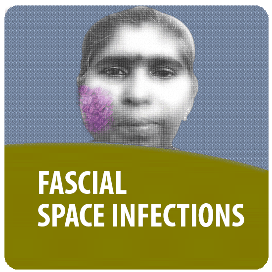 Fascial Space Infections Richardson dental and craniofacial Hospitalposts