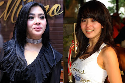 artis yang operasi plastik wajah artis korea operasi plastik wajah artis indonesia yg oplas wajah artis oplas yang gagal artis operasi plastik yang gagal jambul katulistiwa