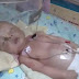 BEBÊ COM UM MÊS DE VIDA É SALVO POR UM CACHORRO APÓS SER ENTERRADO VIVO