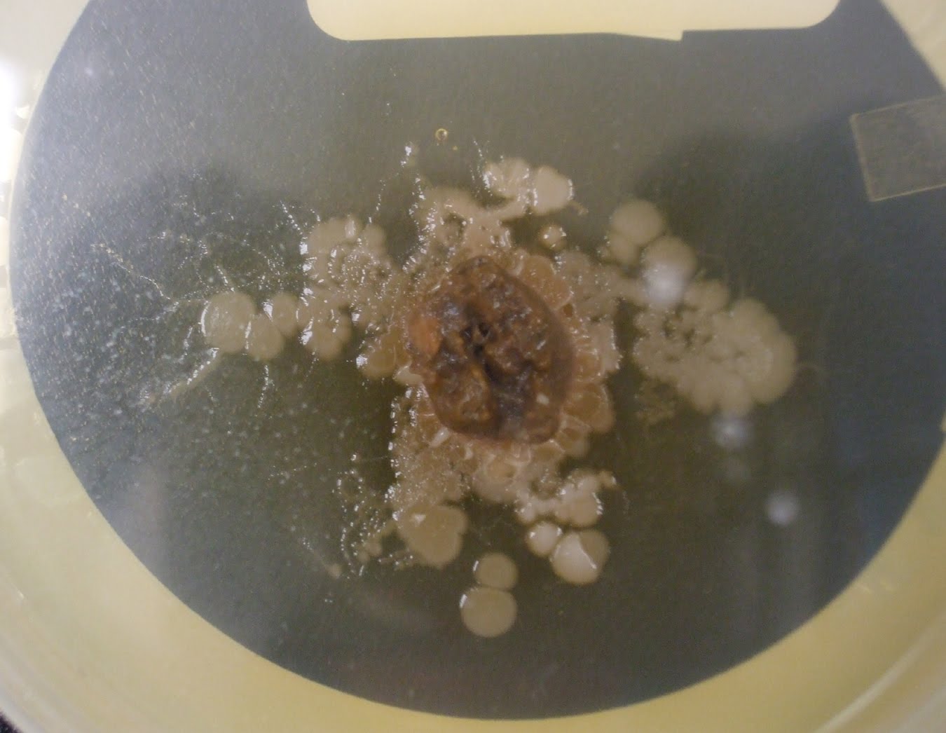 Creepy Dreadful Wonderful Parasites: February 2011
 Pinworm Eggs In Poop