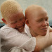 BREAKING NEWS: UN Demands Urgent Action Against Increasing Attacks On Albinos in Malawi and East Africa 