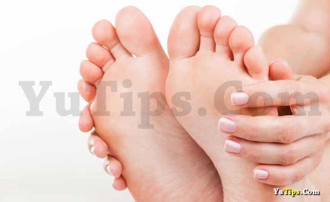 8 Cara Ampuh Mencegah Dan Mengobati Kutu Air Dengan Cepat