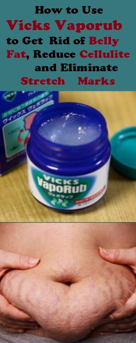 Does Vicks Vapor Rub Help Burn Belly Fat How to Use Vicks VapoRub to Get Rid of Belly Fat and Cellulite