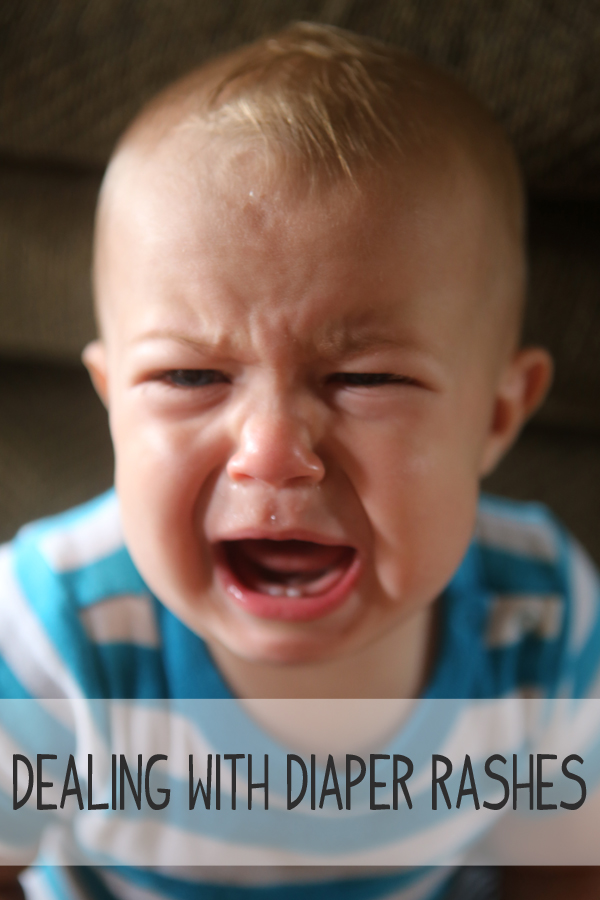 CUTLEROLOGY Diaper rashes.