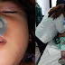 Nagulat ang Magulang ng bata Matapos makita sa X-Ray ang bagay na pinasok nito sa kanyang Ilong.
