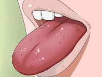 Goût amer dans la bouche goût amer dans la bouche causes