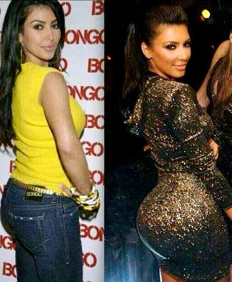 Picconn Check Out Kim Kardashian Before And After Her Butt Implants