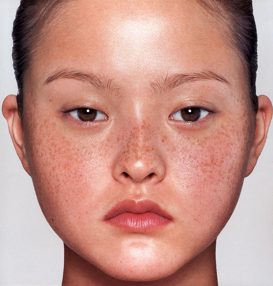 Freckled Asian 12