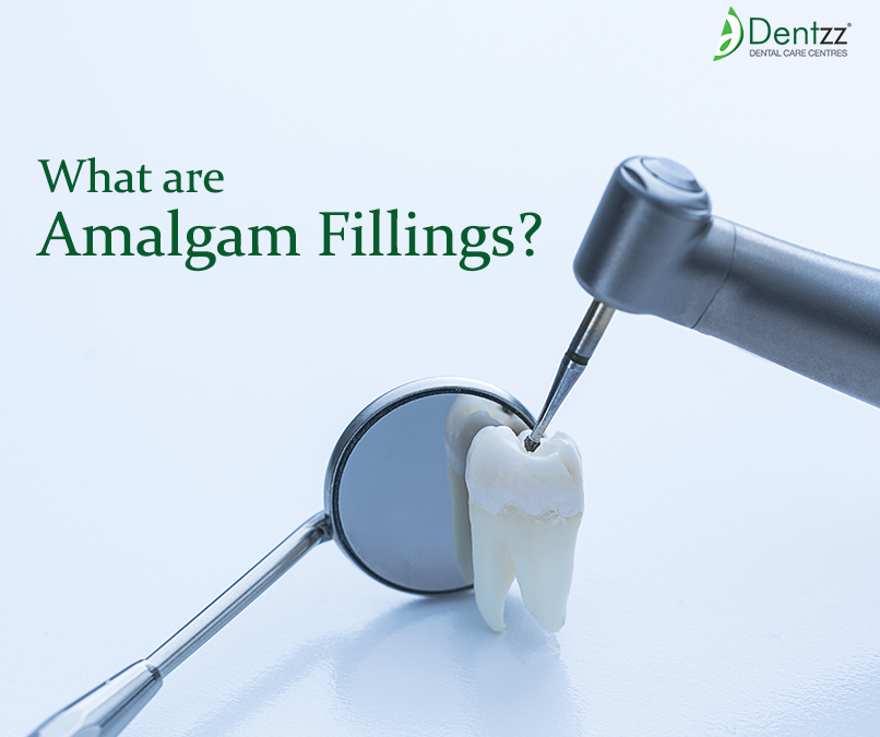 Oral health treatment and consultation by Dentzz Dental Toxic Teeth