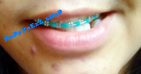 Happynezz Shop Behel BracKet asLi Motif power chain Happynezz Shop Behel BracKet asLi Motif power chain