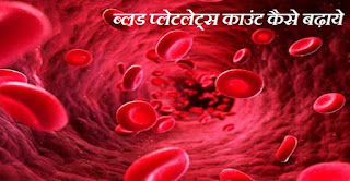 खून के प्लेटलेट्स कैसे बढ़ाये , Home Remedies to Increase Blood Platelets Count in Hindi , ब्लड प्लेटलेट्स कैसे improve ho, gharelu nuskhe se blood platlets ko kaise badhaye, खून में प्लेट्स की मात्रा बढ़ाने का तरीका, 