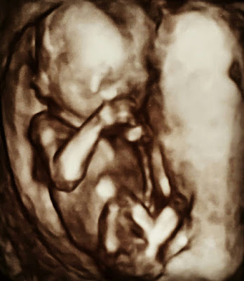 18 haftalık gebelik görüntüsü