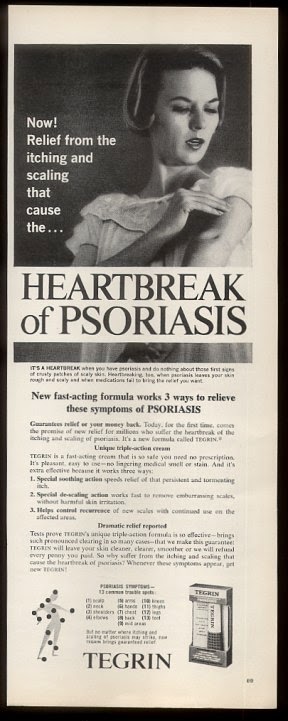 kenneth in the (212): The Heartbreak of Psoriasis