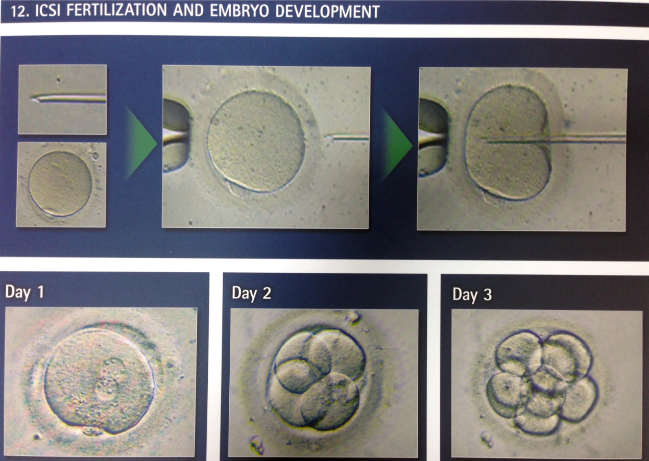 эмбрион не прижился причины. прикрепление эмбриона к матке. плодное яйцо в матке на 3 недели беременности. эмбрион не прижился причины. эмбрионы отличники.