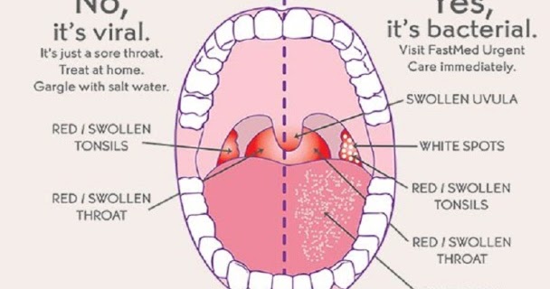 Bio Geek Strep Throat