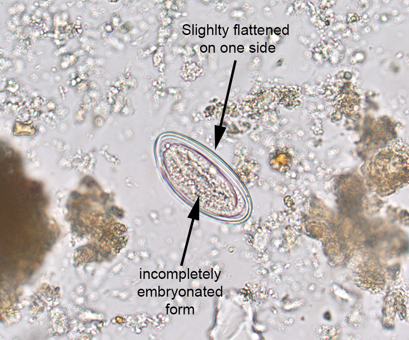 Creepy Dreadful Wonderful Parasites
Pinworm Eggs In Poop