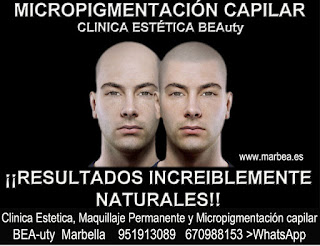 Micropigmentación capilar Marbella CLINICA ESTÉTICA MARBELLA  - uno de los centros más reconocidos, prestigiosos y especializados de España en Marbella 