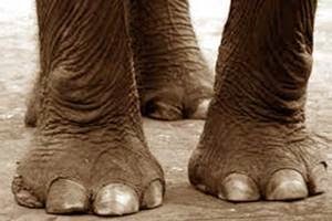 Tips Sehat Menghindari Penyakit Kaki Gajah - Mastah Tehno