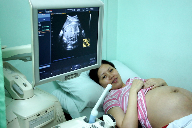 Узи сердца цена в москве взрослому. УЗИ. Эхокардиография сердца. ЭКГ беременной женщине.