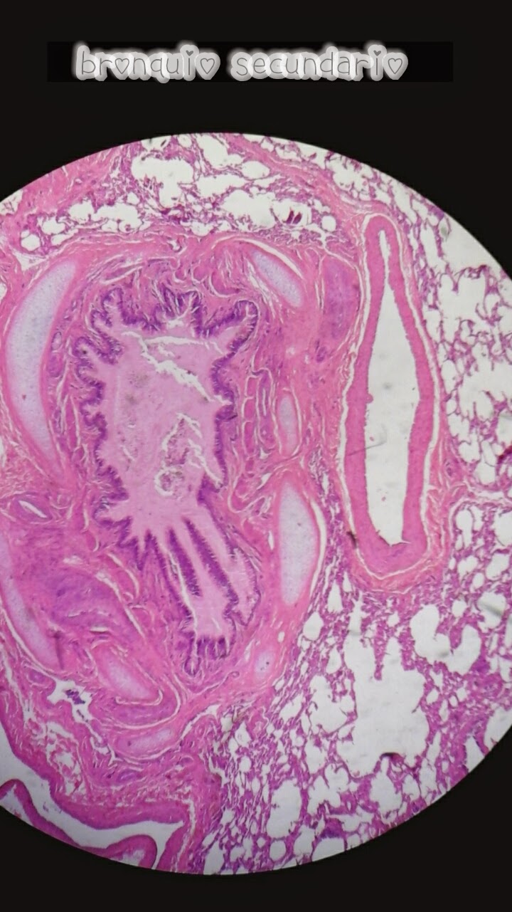 Placas de histología : Sistema respiratorio: Pulmón