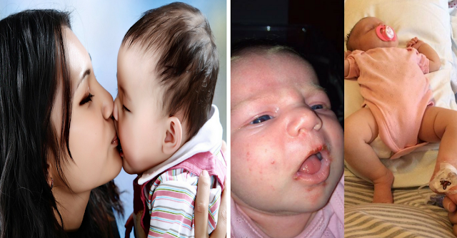 Ternyata Kita Tak Boleh Cium Bibir Bayi yang Belum Tumbuh Gigi, Bisa Timbulkan Kematian