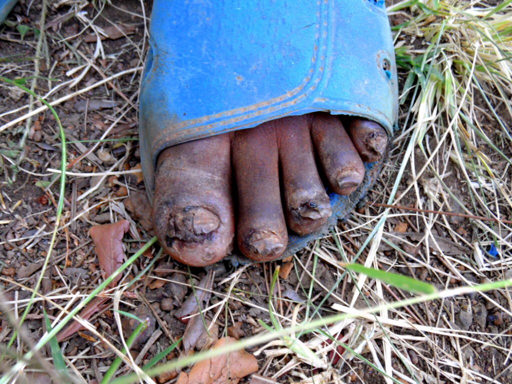The Journey is the Reward Dirt, Bugs, Bites and Beads
