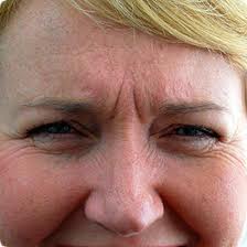 Natural Ways To Get Rid Of Frown Lines Natural Ways To Get Rid Of Frown Lines