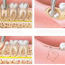 Nhổ răng khôn hàm dưới có nguy hiểm không, có đau đớn gì không?