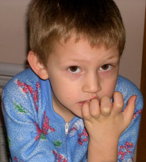 Cocuklarda Tirnak Yeme Aliskanligi Dersteknik Com