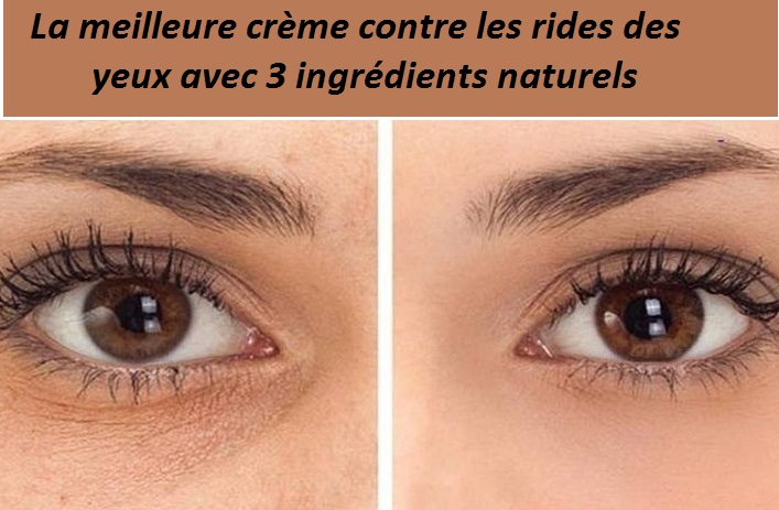 rides aux yeux rides aux yeux