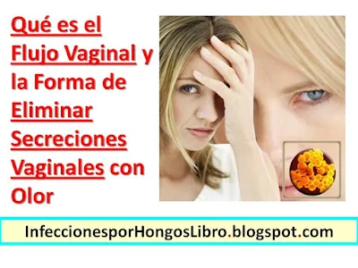 que-es-el-flujo-vaginal-secreciones-vajinales-con-olor-tratamientos