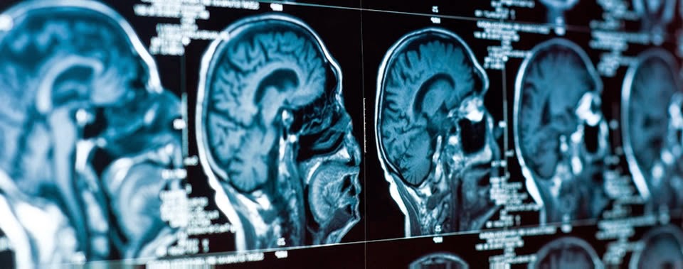 Clermont Radiology S Medical Imaging Blog 2014