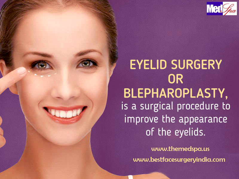 Eye Lift Blepharoplasty (Eyelid Surgery) Information