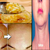 Amazing Garlic Recipe That Can Remove Wrinkles In 7 Days