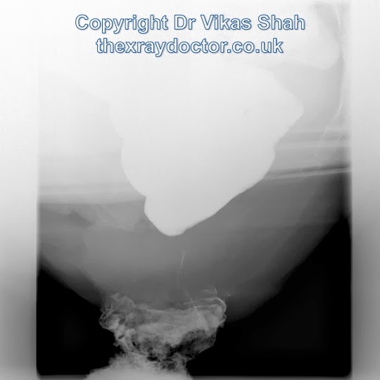 the xray doctor Pelvic floor imaging