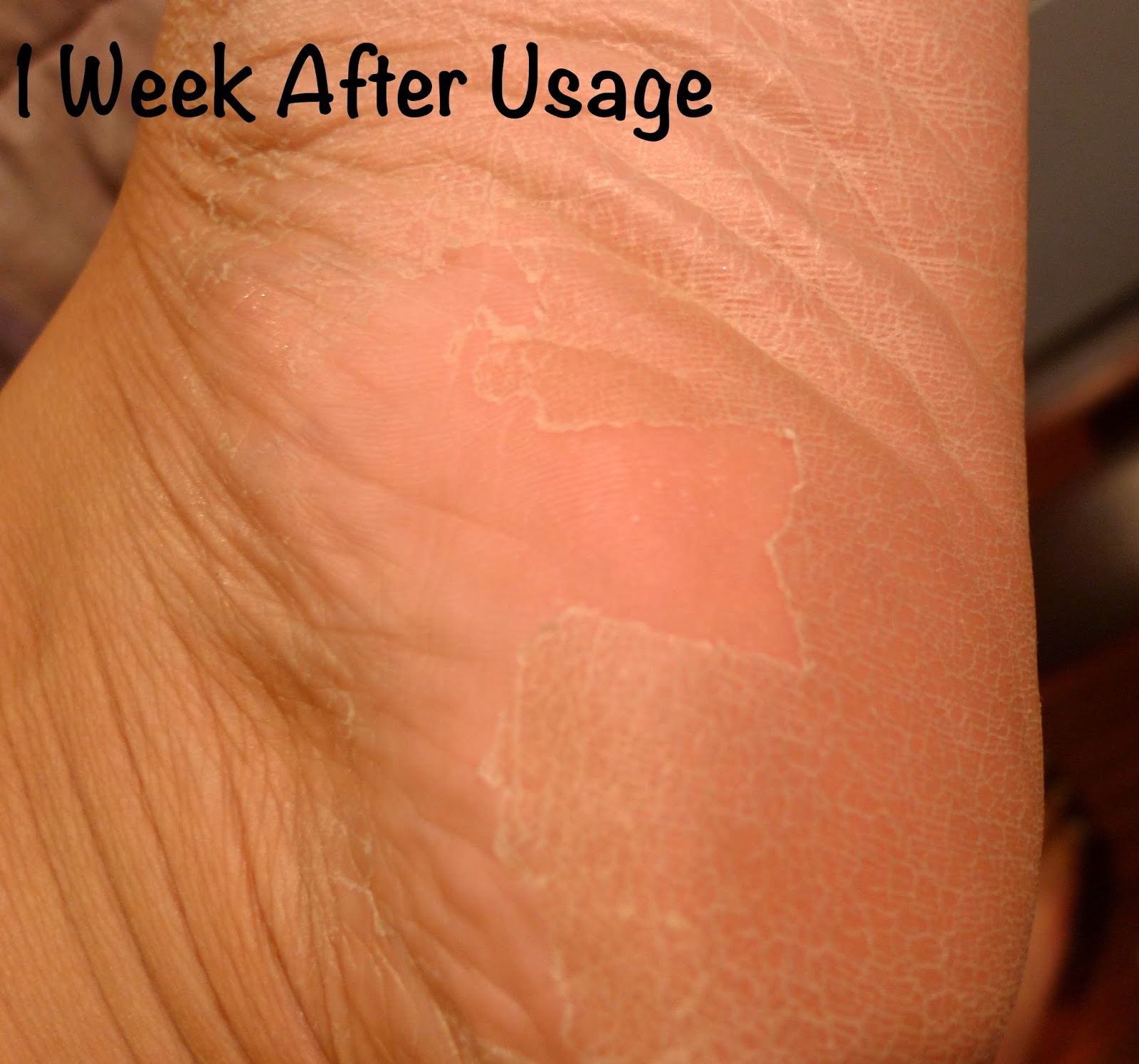 Purederm Exfoliating Foot Mask Review