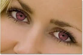 ازالة السواد تحت العين بالشاي،لازالة السواد تحت العين مجربه،علاج سواد تحت العين طبيعيا،خلطة للسواد تحت العين سهله،اسباب السواد تحت العين عند الشباب.