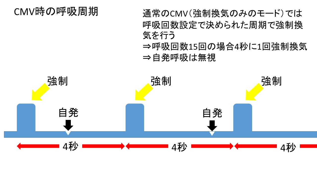 ブログタイトル Title 人工呼吸器のトリガーウィンドを図を使って解説 臨床工学技士による呼吸療法勉強会
