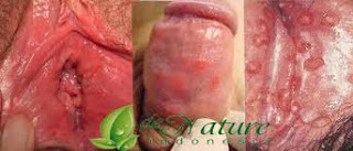 Foto Obat alami atasi Pipis Sakit Dan Keluar Nanah