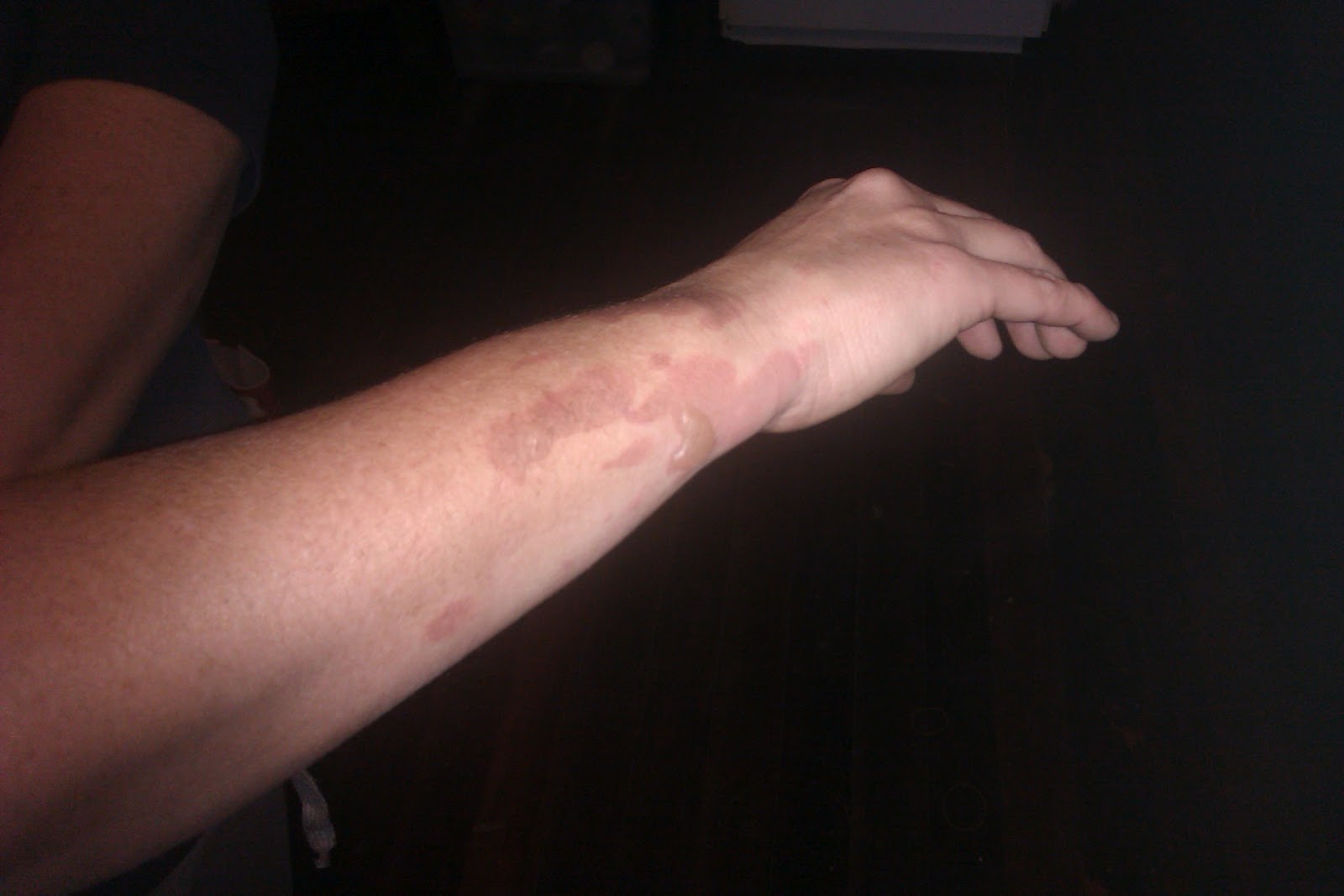 Jen's Busy Days Recent owies!