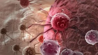 El truco del cáncer para esquivar el sistema inmunológico