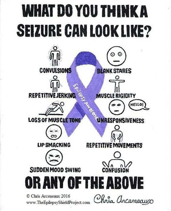 seizure after effects seizure after effects