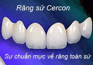 Vậy giá bọc răng sứ Cercon bao nhiêu?
