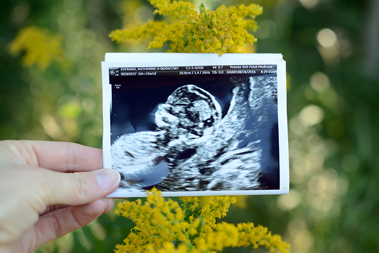 Pregnancy Announcement; Baby E | My Darling Days Pregnancy Announcement; Baby E | My Darling Days